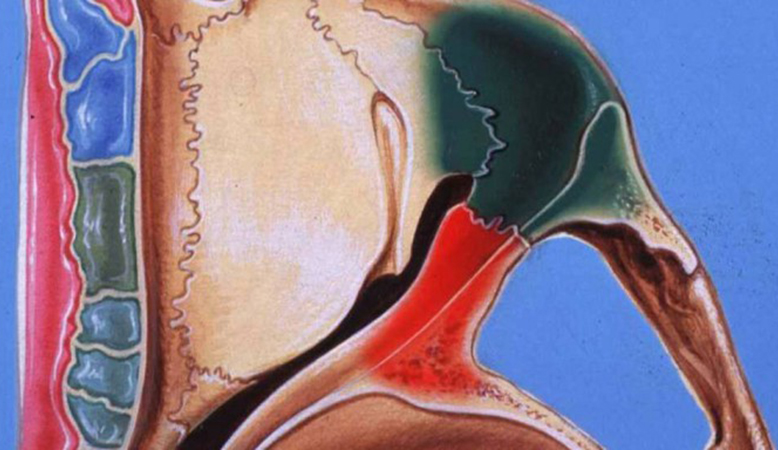 Oftalmopatía tiroidea